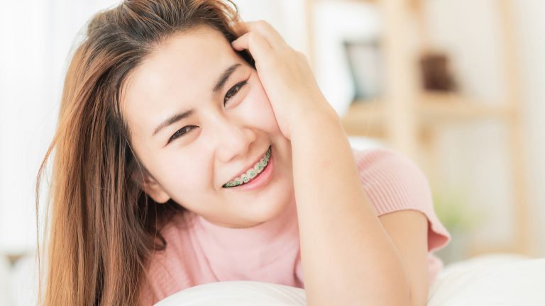 7 motivos para ter um sorriso alinhado